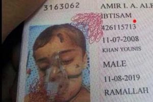 Gazzeli yaralı &ccedil;ocuğa pasaport
