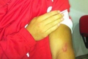 İtalya'da Luis Suarez vakası!