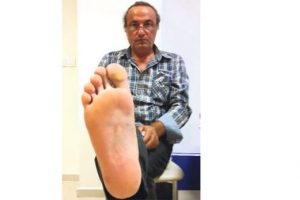 İşkence su&ccedil;una zamanaşımı