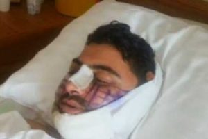 &Uuml;st ge&ccedil;it faciasından kurtulan Zerey, dehşet anlarını anlattı