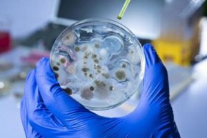 İngiliz iş adamı ebola kurbanı