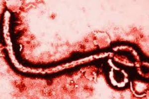 Rusya'da Ebola vir&uuml;s&uuml;ne karşı 3 aşı &uuml;retiliyor