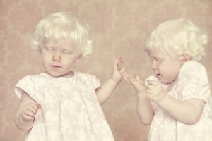 Albino &ccedil;ocuklar koruma altına alınıyor