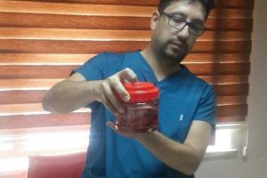 2 yaşındaki &ccedil;ocuğun b&ouml;breğinden 300 gram kist &ccedil;ıktı