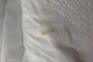 Hapşırınca burnundan bunlar &ccedil;ıktı!