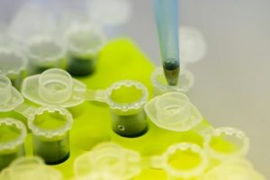 Ebolanın &ccedil;aresi bu ila&ccedil; mı ?