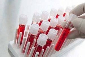 Kan tahlilinde yeni buluş