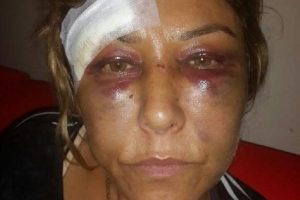 Bu hale getiren saldırganın serbest kalmasına tepki g&ouml;sterdi!