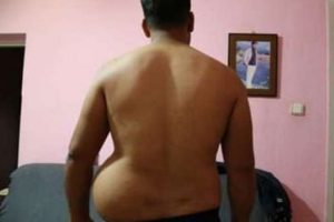 Reyhanlı saldırısı hayatını kararttı