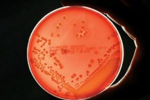 Antibiyotik yerine 's&uuml;per enzim'