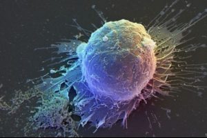 Parkinson'da '&ccedil;ığır a&ccedil;an' k&ouml;k h&uuml;cre buluşu