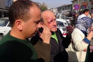 S&uuml;r&uuml;c&uuml; hastanelik etti