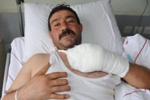 4 ayda 2 iş kazası, 6 parmak!