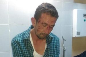 Dur ihtarına uymadı iki polis yaralandı