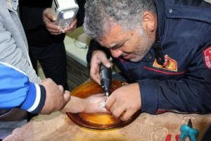 Şişen parmaktaki y&uuml;z&uuml;ğ&uuml; itfaiyeci &ccedil;ıkardı