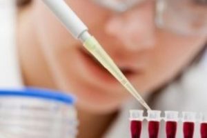 O hastalıkların testleri T&uuml;rkiye'de yapılabilecek