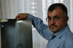 Sırtındaki mermiyle yaşıyor