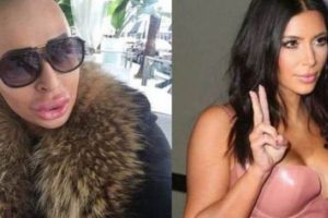 Kim Kardashian'a benzemek i&ccedil;in bakın ne yaptı...