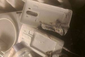 Telefon patladı, bu hale geldi
