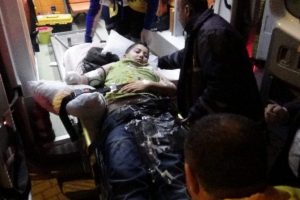13 yaşındaki &ccedil;ocuğun kopan kolu yerine dikildi
