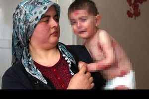 "Kızım mum gibi eriyor yardım edin"