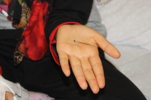 Nefes borusundan &ccedil;ıktı