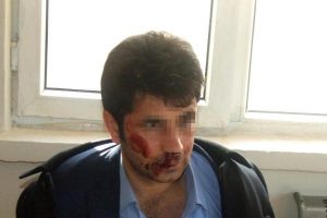 Sen misin sahte polis olan!