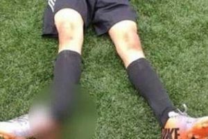 Dil boğaza ka&ccedil;tı, ayak kırıldı ve ma&ccedil; yarım kaldı!