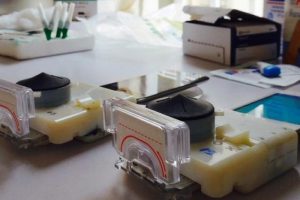 Cep telefonları HIV testi yapabilecek!
