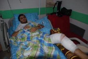 Kavgayı ayırmak isterken hastanelik oldu