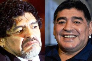 İşte estetik ameliyatın ardından Maradona'nın yeni y&uuml;z&uuml;