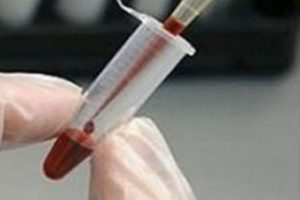 Kanser tedavisinde &ccedil;ığır a&ccedil;acak keşif