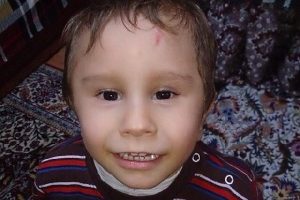 Minik Umut Arda yaşam savaşını kaybetti