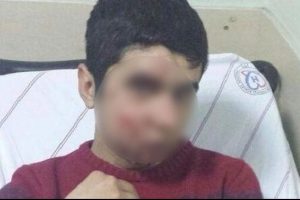 Gaz kaps&uuml;l&uuml; değil taş yaralamış