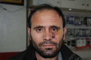 Silahlı soygun girişimi kameralara yansıdı
