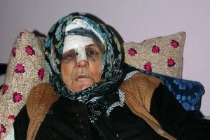 Maskeli saldırgan 76 yaşındaki kadını d&ouml;vd&uuml;