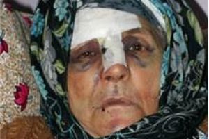 76 yaşındaki kadına bu yapılır mı?