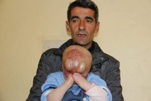 O daha 4 yaşında: Yardım edin !
