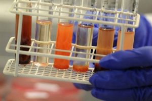 SGK kapsamında 3 bin hastaya test yapılacak