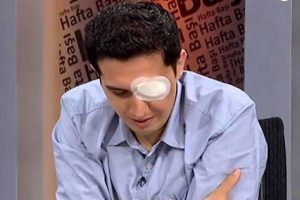 Akademisyen'in g&ouml;z&uuml;n&uuml; b&ouml;yle &ccedil;ıkarmışlar!