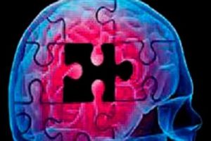 Alzheimer'a ultrason umudu