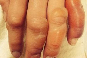 Uyandığında parmakları bu haldeydi