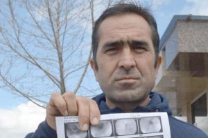 'İnat&ccedil;ı hı&ccedil;kırıktan' kurtulmak istiyor