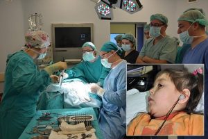 Konuşmayı "biyonik kulak" ile &ouml;ğreniyorlar