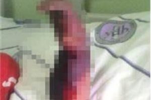 Karın ağrısı diye gitti kolunu kestiler!