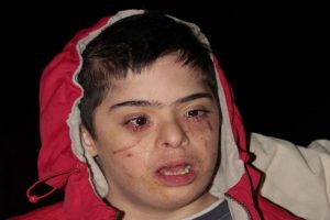 Eve &ouml;yle bir halde geldi ki! Babası isyan etti