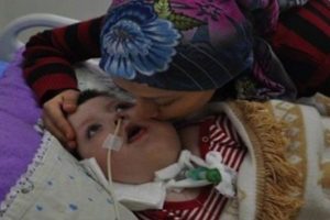 Soma'da babasını kaybeden Enes hayatını kaybetti