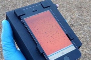 Kandaki parazitleri akıllı telefon ile g&ouml;r&uuml;nt&uuml;lemek m&uuml;mk&uuml;n!