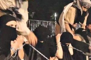 "20 kez bekaret ameliyatı ge&ccedil;irdim"