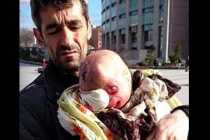 T&uuml;rkiye'yi ağlatan bebeğin babasına şok su&ccedil;lama